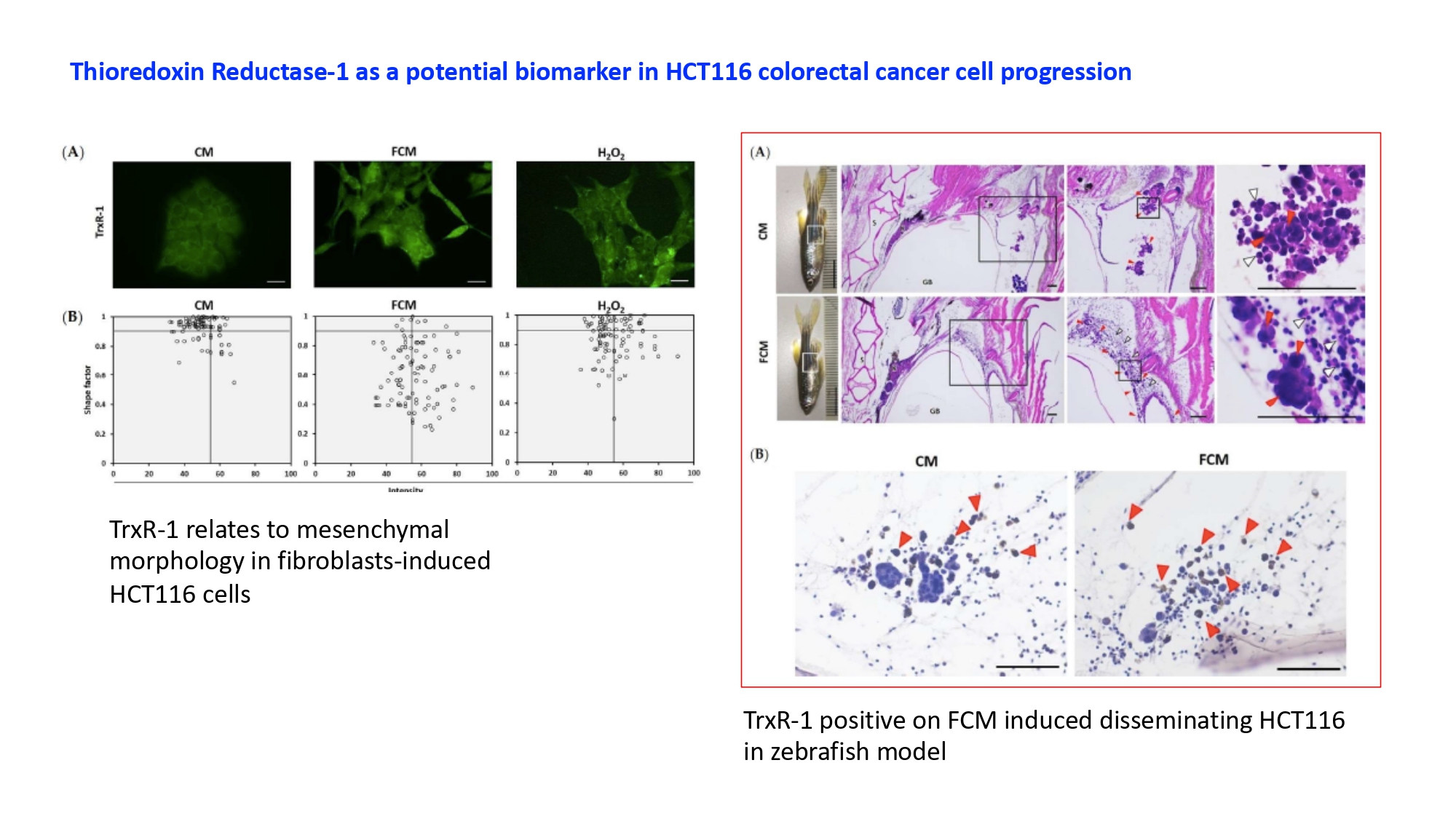 Thioredoxin Reductase-1 as a Potential Biomarker in Fibroblast-Associated HCT116 Cancer Cell Progression and Dissemination in a Zebrafish Model